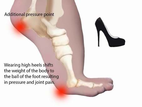 heel that turns into a flat