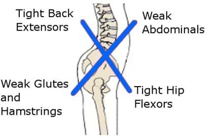 Sciatica scan