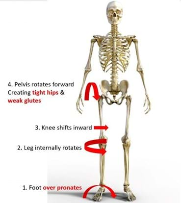 Do Tight Hip Flexors Correlate to Glute Weakness?